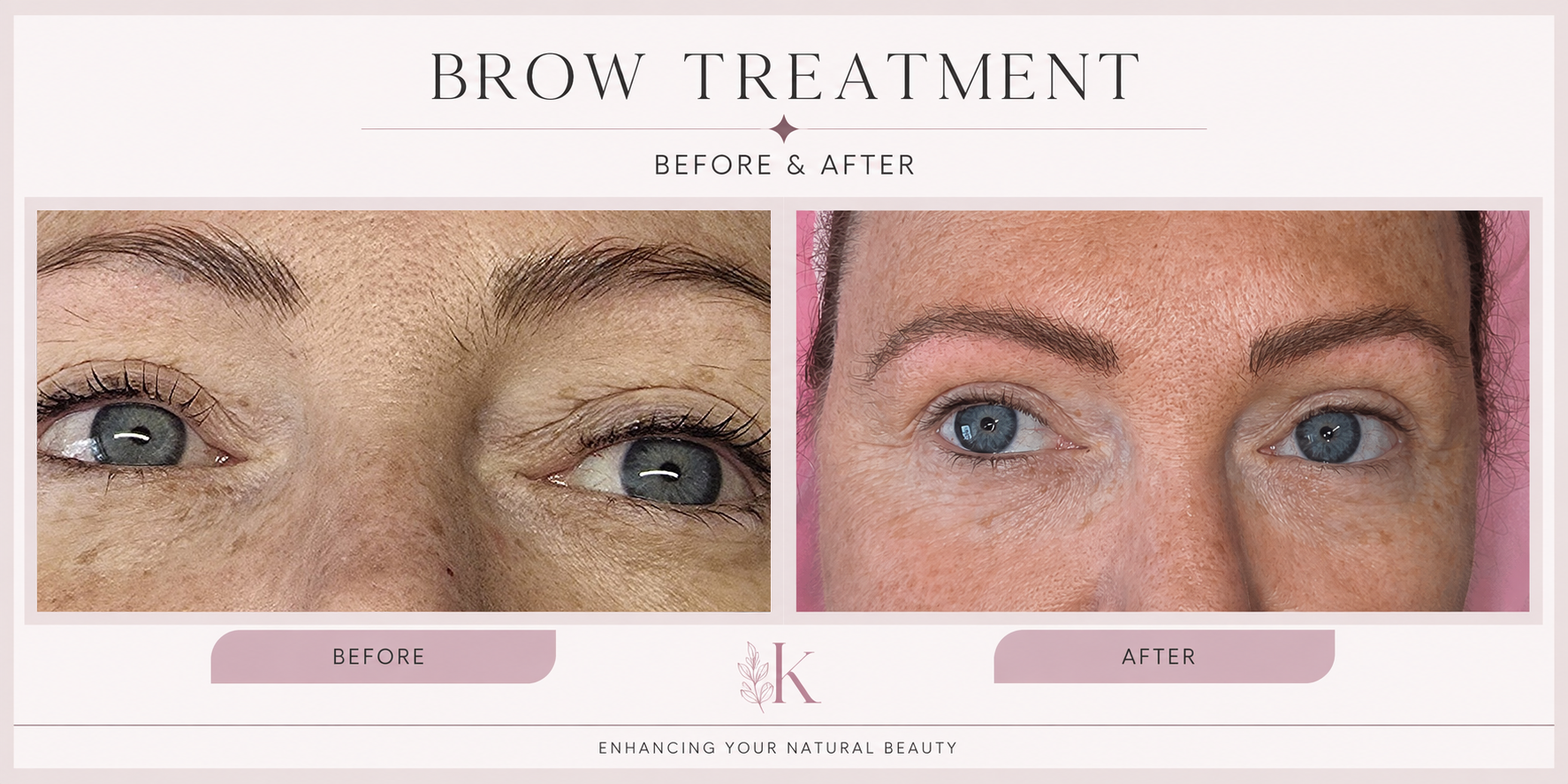 Brow treatment before and after